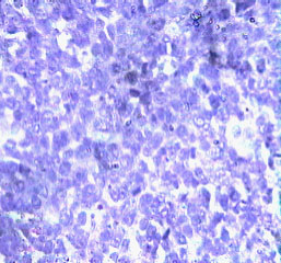 Imagen de Induccin de apoptosis y efecto antiangiognico del preparado vacunal 1E10/Al en el modelo tumoral de Lewis 3LL-D122.