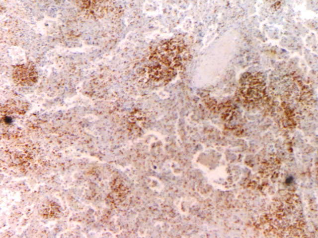 Fig. 8: CD43 - <div style=