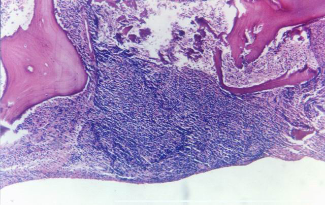 Fig. 2. Mdula sea, Hematoxilina-Eosina. - <div style=