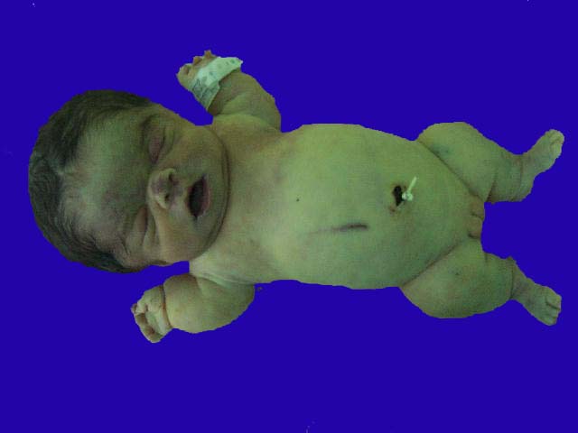 Autopsia 34469 - <div style=