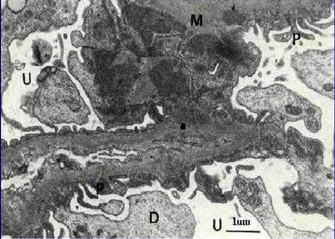 Microscopa Electrnica de Transmisin - <div style=