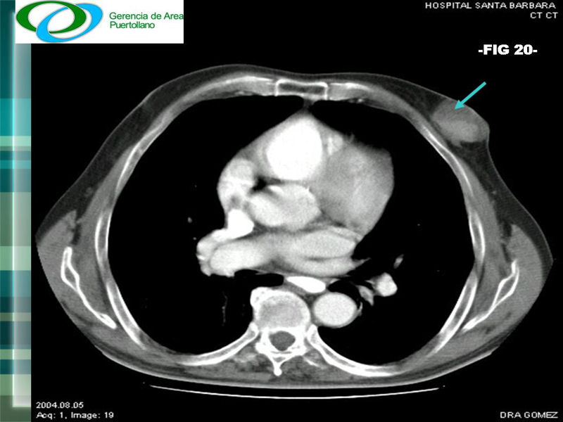 fig. 20 - <div style=