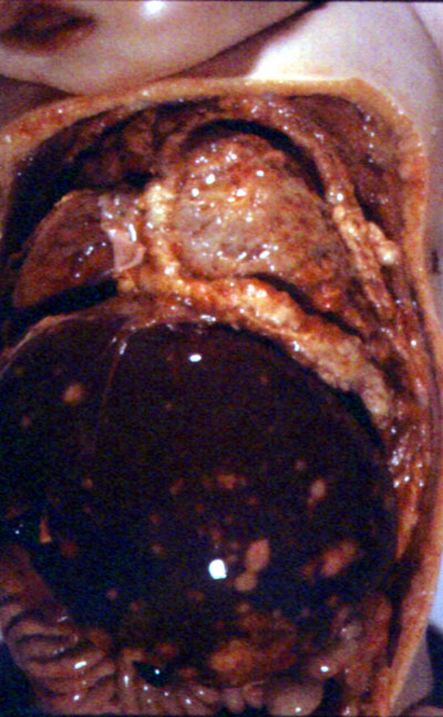 fig.2