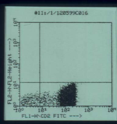 lplt7.jpg (21157 bytes)
