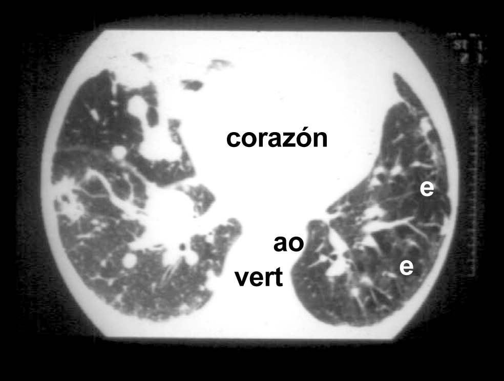 t12_10.jpg (40539 bytes)