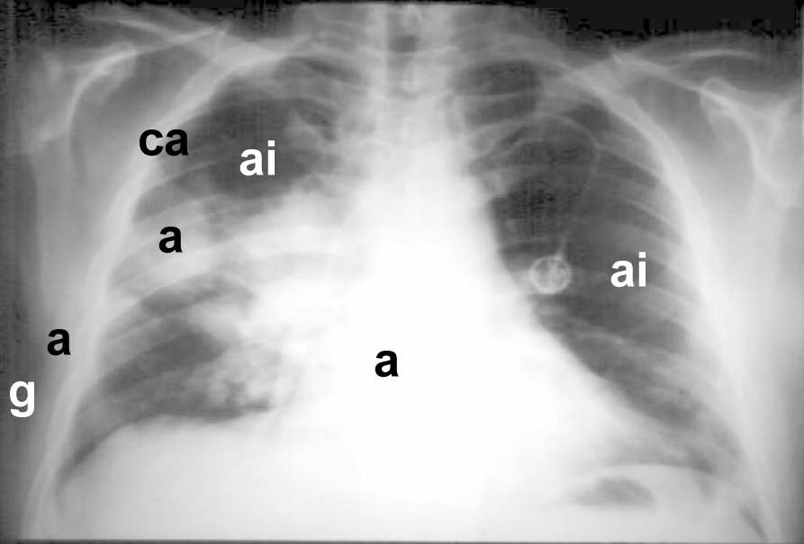 Fig 9