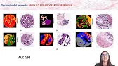 Vdeo Prediccin de inestabilidad de microsatlites en cncer colon a partir de hematoxilina-eosina